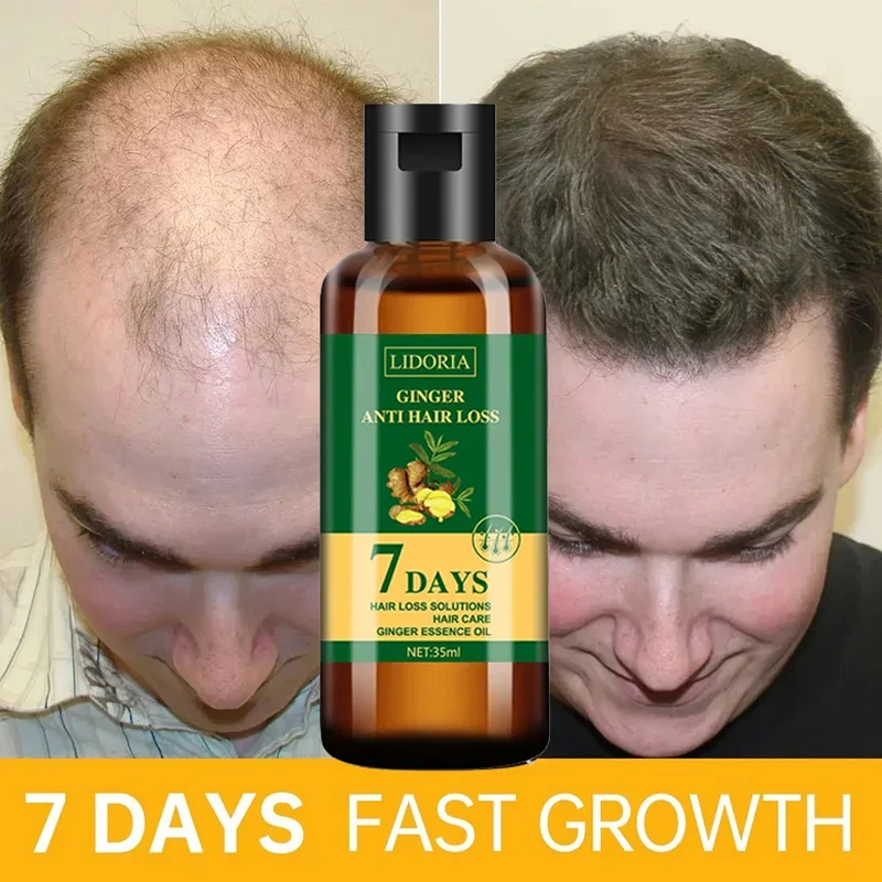 Hair Care Essential Oil Atomizing - Imbirowy olejek eteryczny na porost włosów