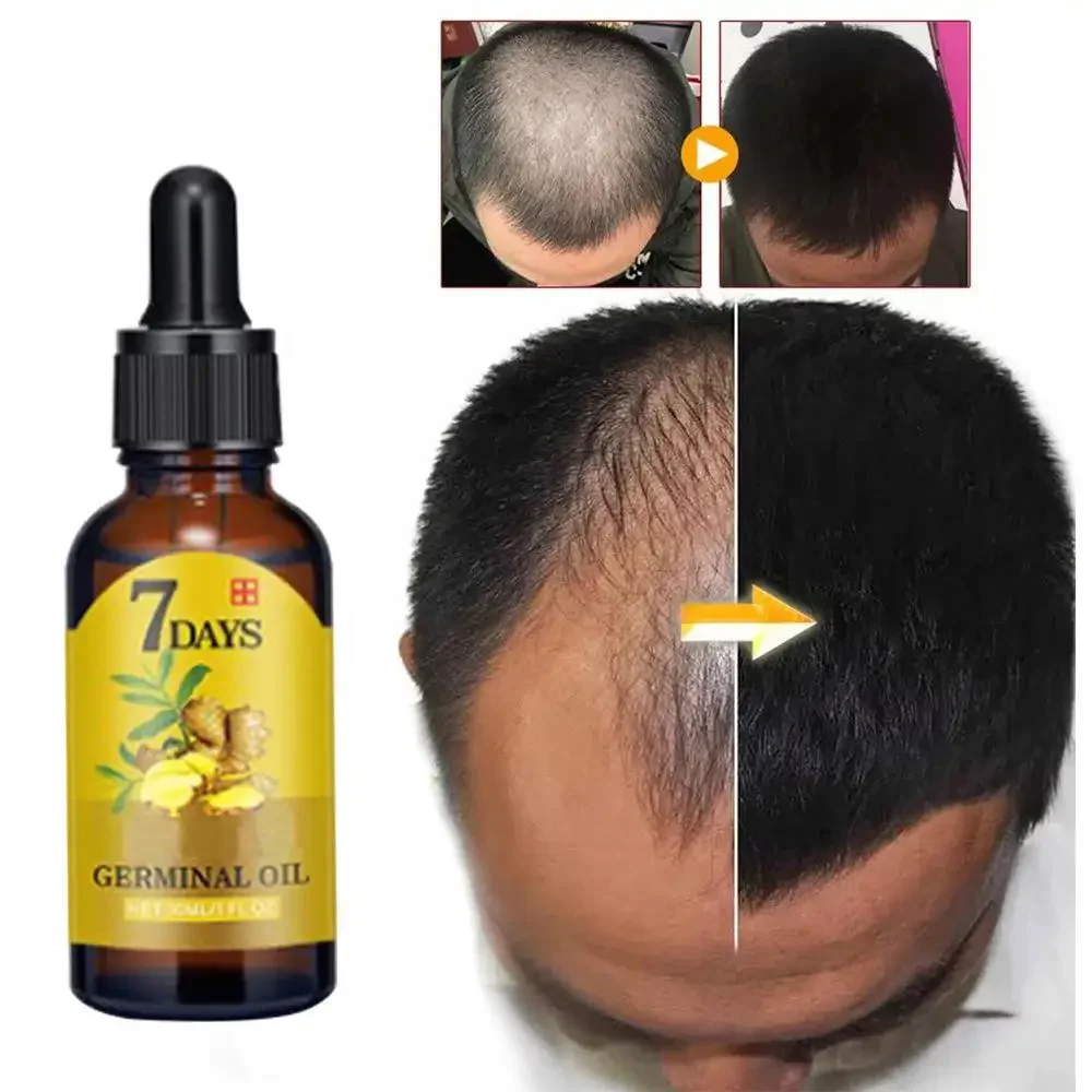 Hair Care Essential Oil Atomizing - Wzrost włosów Imbir Szybko rosnące włosy