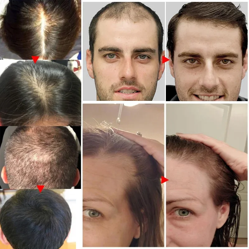 Imbirowy olejek eteryczny na p – Hair Care Essential Oil Atomizing recenzja i cena
