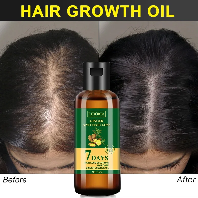 Imbirowy olejek eteryczny na p – Hair Care Essential Oil Atomizing recenzja i cena