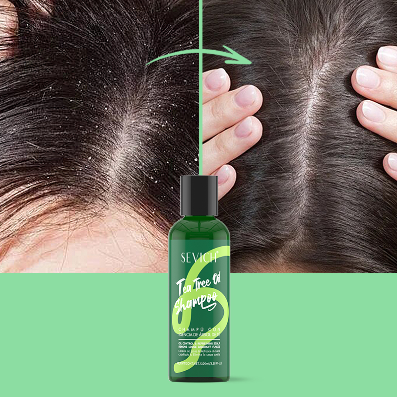 Zestaw Szamponu i Odżywki z Es – Hair Care Conditioner recenzja i cena