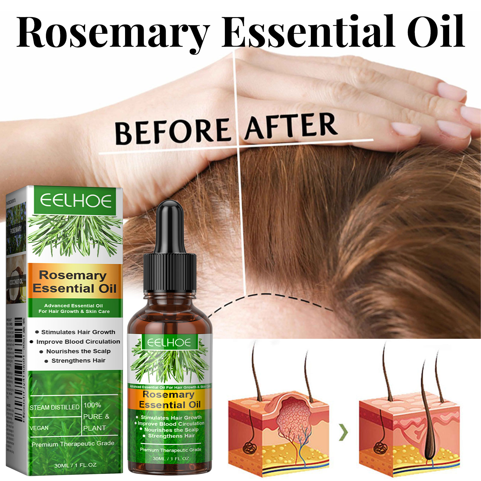 Serum na porost włosów Szybko  – Hair Care Essential Oil Atomizing recenzja i cena